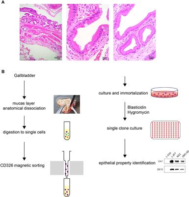 Establishment and characterization of an immortalized epithelial cell line from human gallbladder